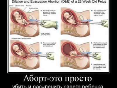 Я ИМЕЮ ПРАВО НА ЖИЗНЬ! – В Актовом зале Новозыбковского филиала Брянского Государственного Университета имени академика И.Г. Петровского состоялся семинар о пагубности абортов